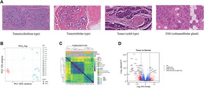 Transcriptomic insights into adenoid cystic carcinoma via RNA sequencing